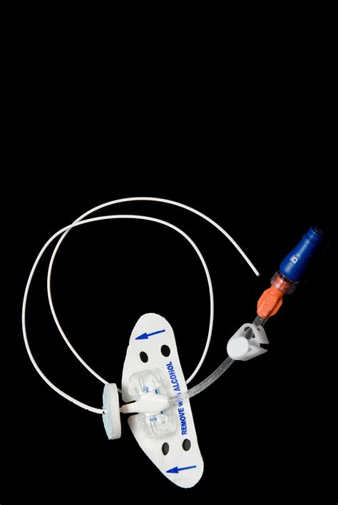 PowerPort / Venous Catheter - Vigna Law Group