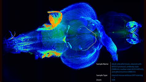 ALPHA 3 Light Sheet Fluorescence Microscope For Fast And Accurate 3D