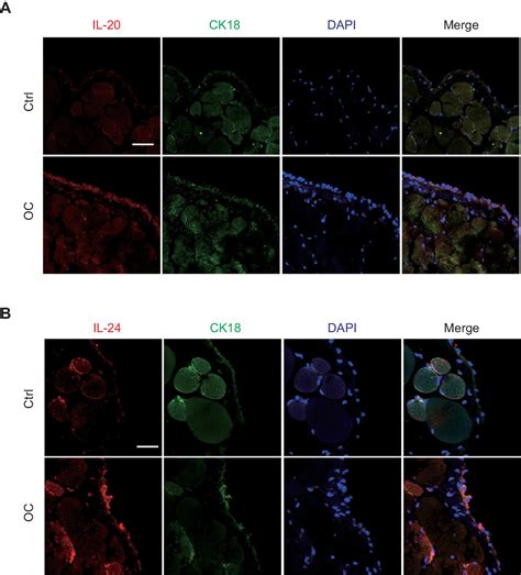 Figures And Data In A Systematic Crispr Screen Reveals An Il Il Ra