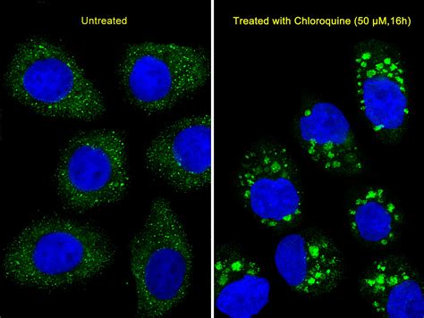 Rabbit Anti Lc Polyclonal Antibody N Term Absin