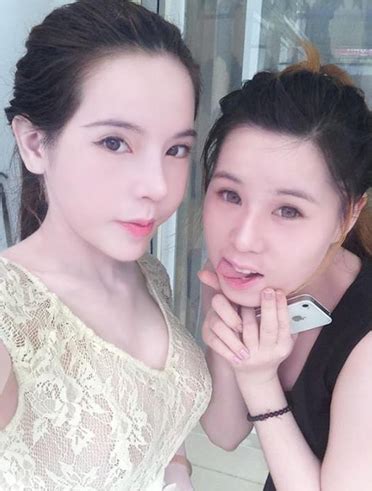 Hot girl Vân Tokyo lột xác hoàn toàn nhờ phẫu thuật thẩm mỹ TS BS Lê Tấn Hùng Thẩm mỹ viện