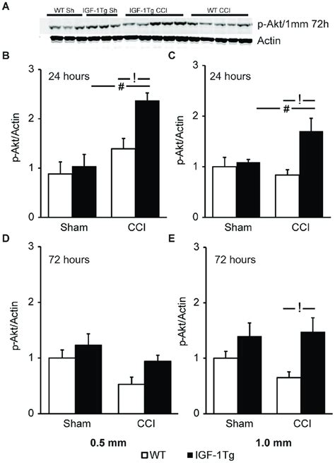 Akt Phosphorylation Is Augmented In Igf Tg Mice A Representative