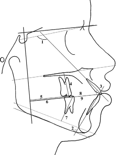 Dental Angular Measurements 1 U1 Sn Plane 2 Impa 3 U1 L1 Download Scientific Diagram