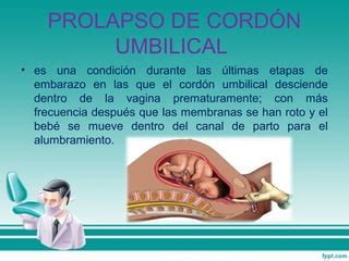 Prolapso De Cordon Umbilical PPT