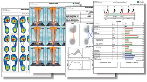 Gait Analysis London Running Analysis Gait Lab London