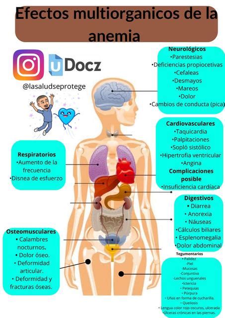 Efectos Multiorg Nicos De La Anemia Lasaludseprotege Udocz