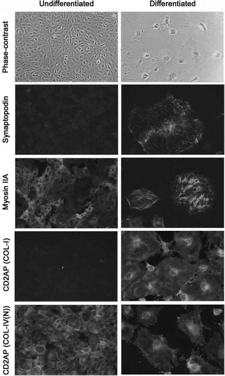 Undifferentiated and differentiated mouse podocyte cell line. The... | Download Scientific Diagram