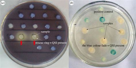 Proteus mirabilis antibiotic susceptibility