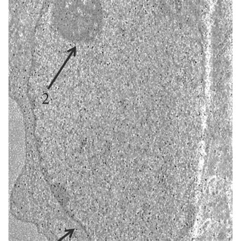 A TEM Ultrastructural Micrograph Of Untreated MCF 7 Cells 1