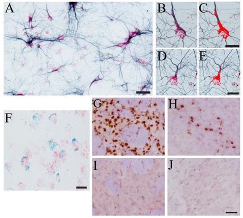 Car Nk Transgene Cytokine Biomarker Protein Biodistribution Analysis