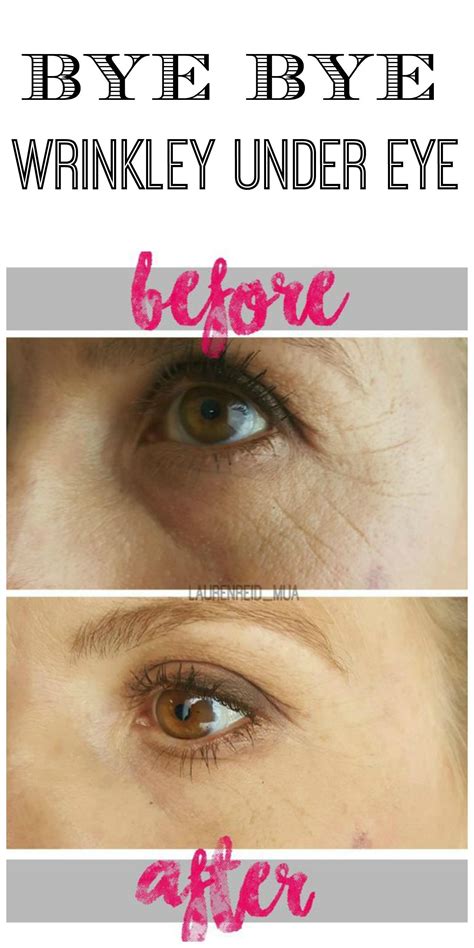 How To Get Rid Of Lines Under Eyes All You Need Infos