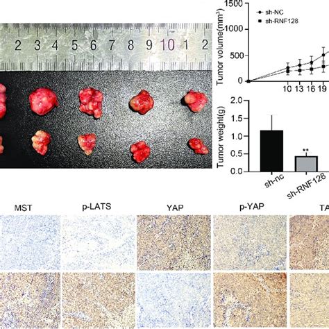 Rnf Promotes Colorectal Cancer Progression In Nude Mice A B