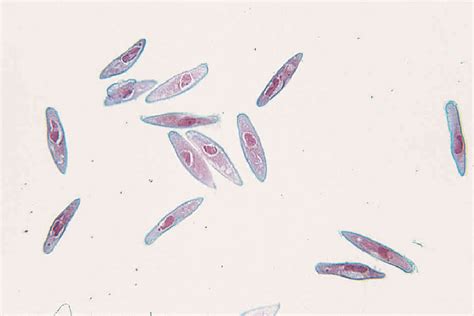 Paramecium caudatum Slide | Prepared Slides