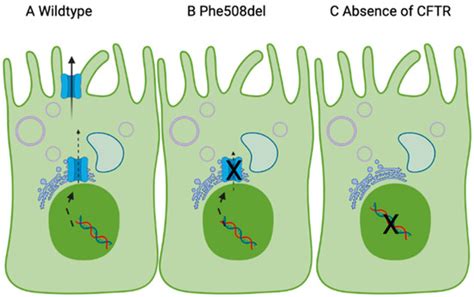 Nutrients Free Full Text Essential Fatty Acid Deficiency In Cystic Fibrosis Disease