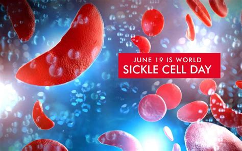 World Sickle Cell Awareness Day 2023