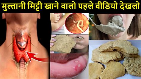 मलतन मटट खन क नकसन Side effects of eating Multani mitti