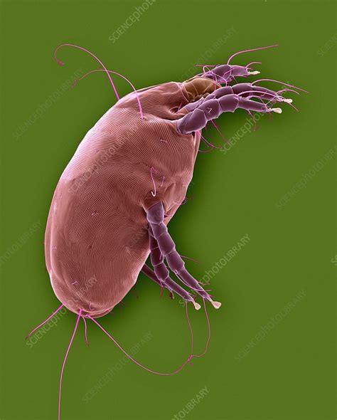 Dust Mite Dermatophagoides Pteronyssinus Sem Stock Image C032