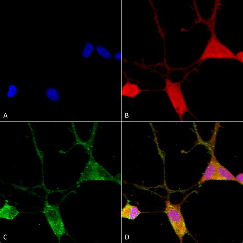 Anti Vglut1 Antibody S28 9 Monoclonal Igg1