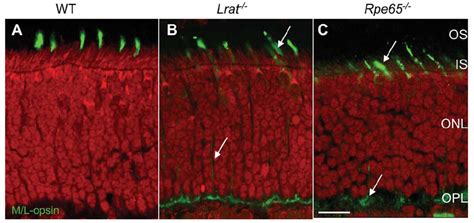 Confocal Immunolocalization Of M L Opsin In Wt Lrat And Rpe