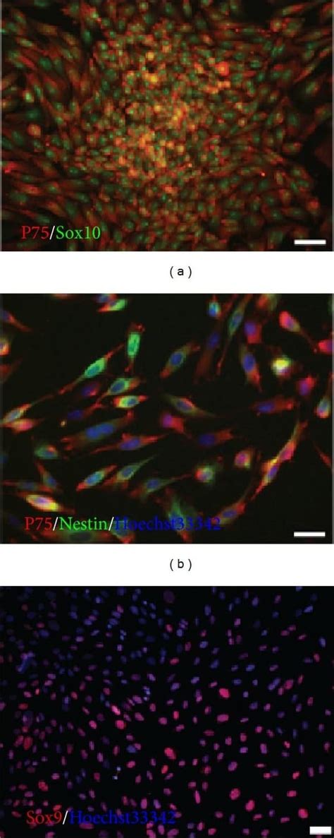 Sox10 Antibody 20b7 Unconjugated Mab2864 Novus Biologicals