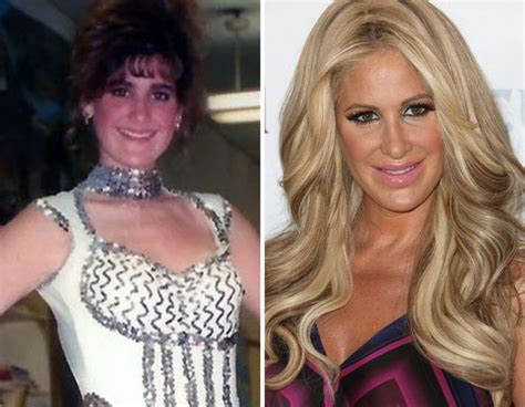 Kim Zolciak Before And After