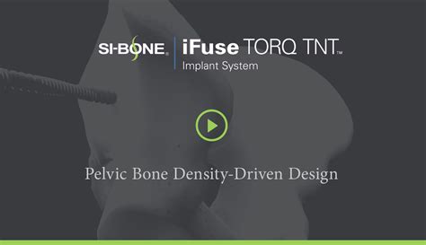 Ifuse Torq Tnt™ Implant System Si Bone