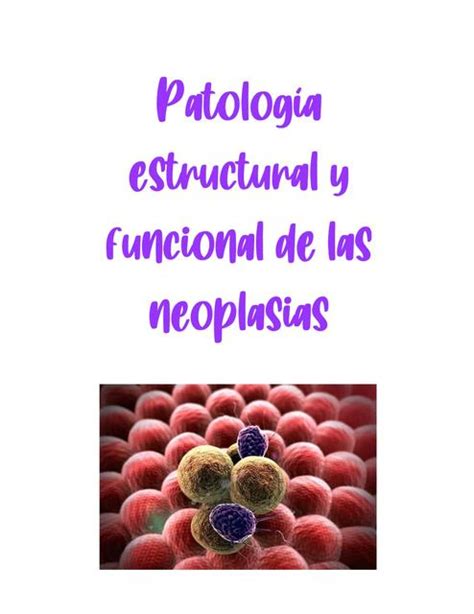 Neoplasias Patolog A Estructural Y Funcional Medicina Zip Udocz