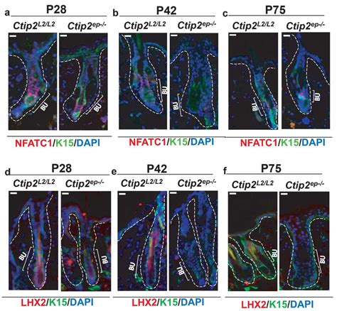 Conditional Ablation Of Ctip In Adult Epidermis Leads To Altered