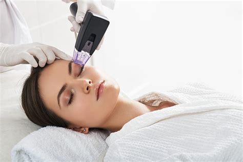 Morpheus8 Rf Microneedling Rejuvenate Your Skin Without Surgery