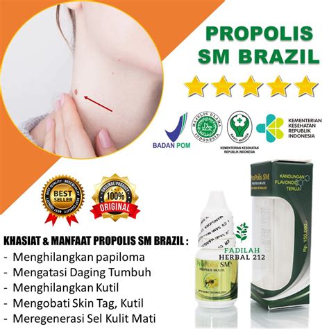 Jual Obat Papiloma Obat Papiloma Di Leher Obat Penghilang Kutil