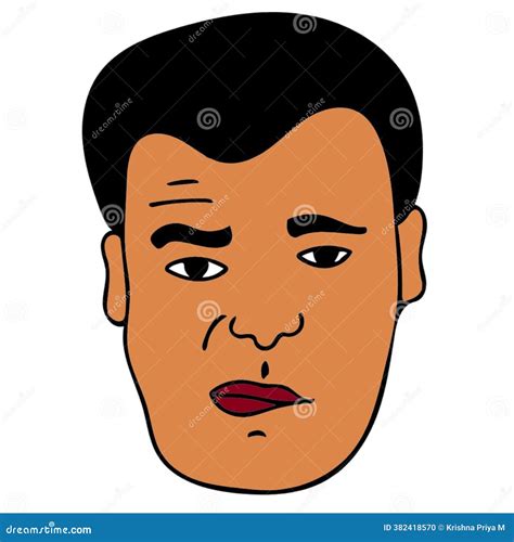 Facial Nerve Paralysis, Bell's Palsy, Illustration Showing Female With