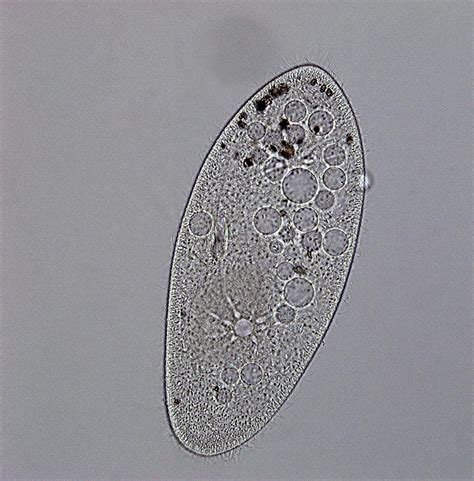 Paramecium Cell Under Microscope