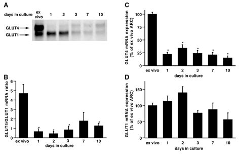 MRNA Expression Of GLUT4 And GLUT1 In ARC After Isolation Ex Vivo And