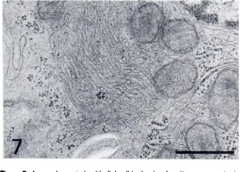 Figure 7 From High Glucose 6 Phosphatase Activity In Non Pigmented