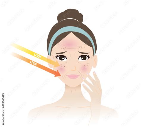 sun damaged skin  woman face vector illustration  white background
