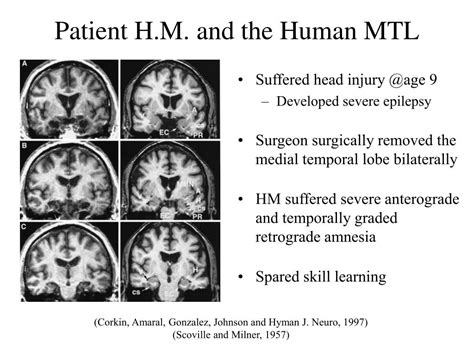 Ppt Hippocampus And Medial Temporal Lobe Functional Neuroanatomy