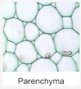 Pictures of Parenchyma collenchyma sclerenchyma under microscope - CBSE ...