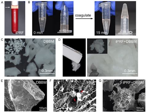 A Preparation Of Injectable Platelet Rich Fibrin Iprf White Arrow