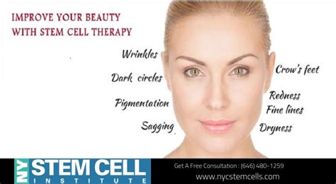 Get Stem Cell Therapy For Improving Your Beauty From Nyc Stem Cell