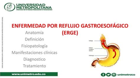 Enfermedad Por Reflujo Gastroesofagico Ppt