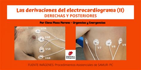 Urgencias Y Emergencias Las Derivaciones Del Electrocardiograma Ii Images And Photos Finder