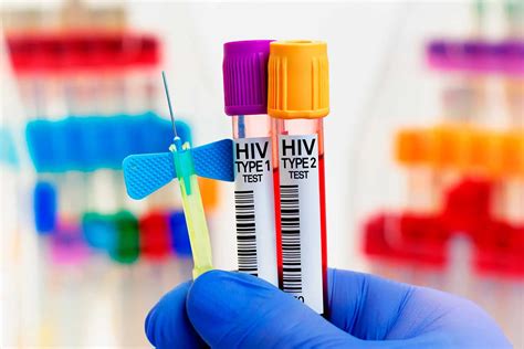 Hiv 1 E 2 Entenda O Que São E Principais Diferenças