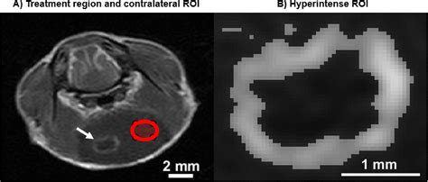 Characterization Of Bloodbrain Barrier Opening Induced By Transcranial