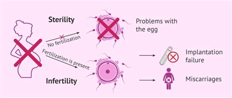 Understanding Infertility Causes Diagnosis And Treatment Ask The