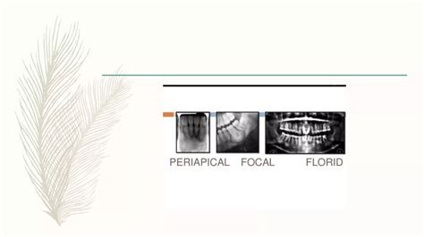 Ossifying Fibroma And Cemental Dysplasia Ppt