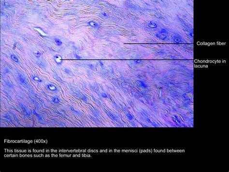 Fibrocartilage Connective Tissue Labeled