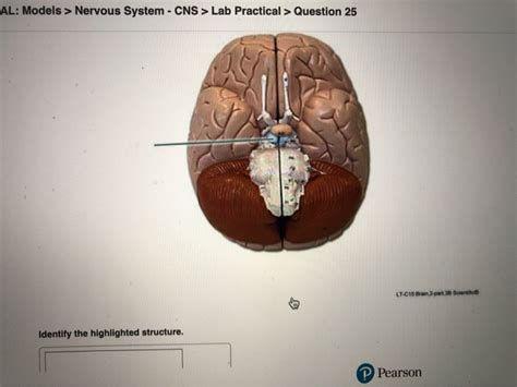 Al Models Nervous System Cns Lab Pr Solvedlib