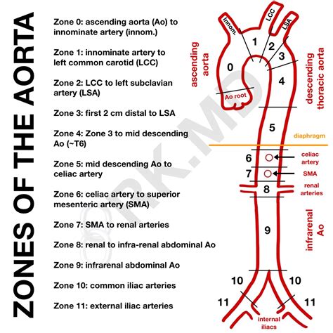 Double Aortic Arch Repair