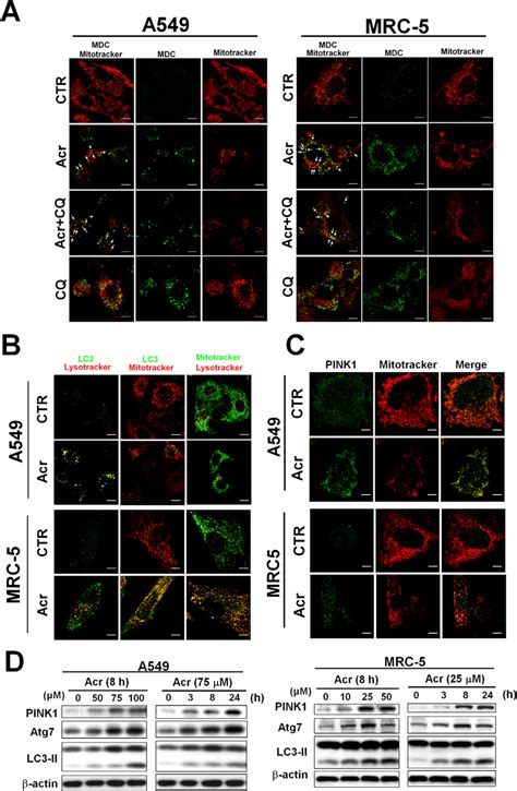 Acrolein Induces Mitophagy In Lung Cells In Panel A A And Mrc