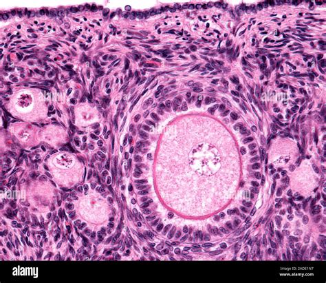 Light Micrograph Of An Ovarian Primary Follicle Showing The Oocyte Surrounded By The Zona